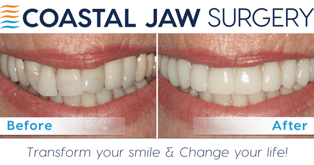 Coastal Jaw Surgery at Trinity photo