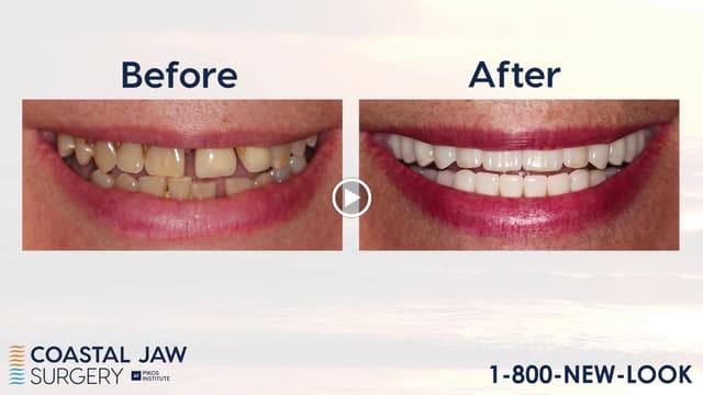 Coastal Jaw Surgery at Trinity photo