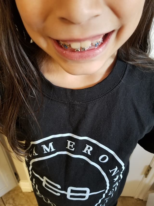 Cameron Orthodontics: Braces & Invisalign photo
