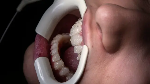 banner image for blog post