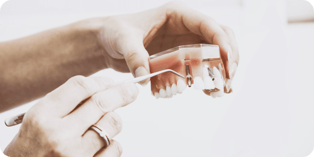 A surgical extraction being performed of a model of a tooth