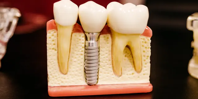 Model of a tooth in a lab